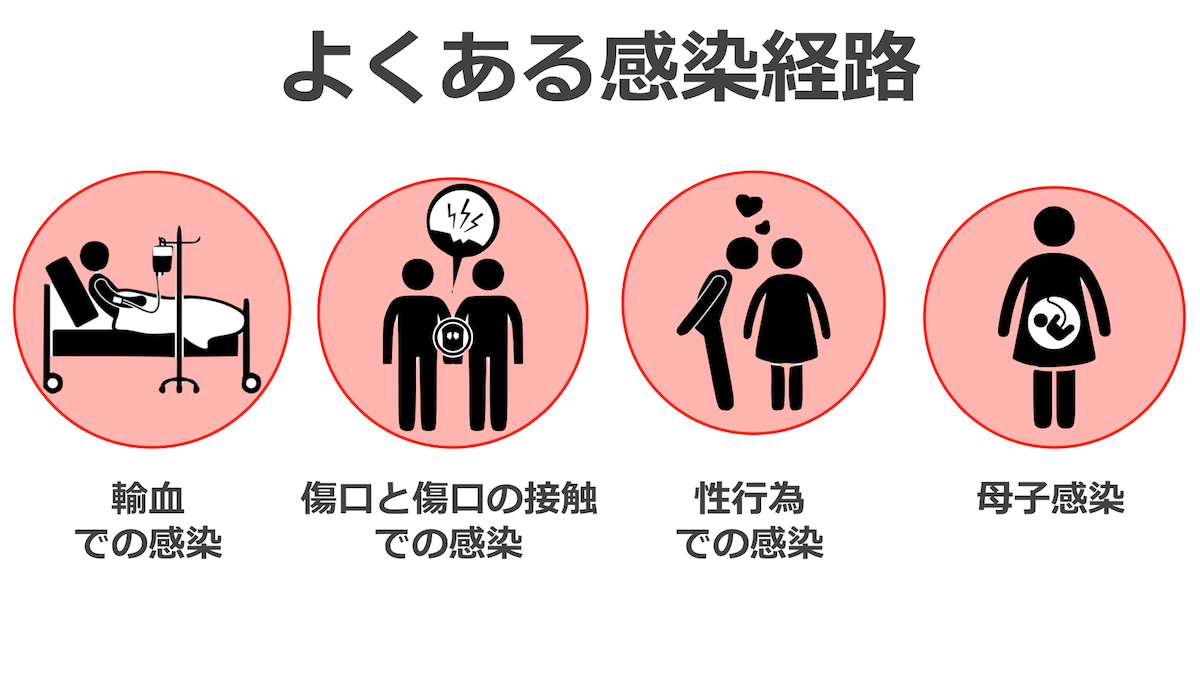 性病 エイズの症状と感染経路 治療法など アベニュース